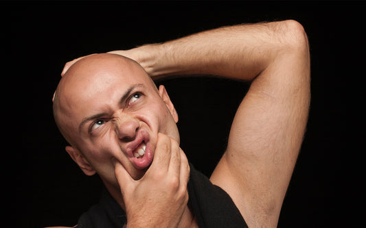 9 Reasons Men Go Bald in Their 30s and What to Do About Them